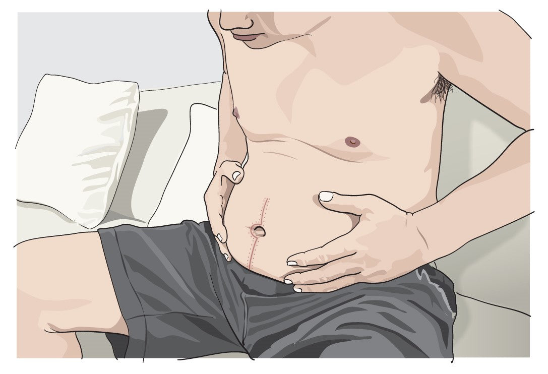 Virtual Patient Case: Malignant Bowel Obstruction