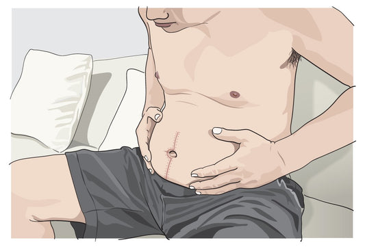 Virtual Patient Case: Malignant Bowel Obstruction